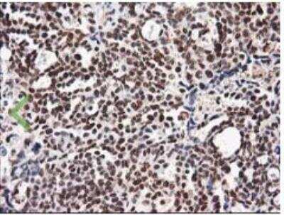 Immunohistochemistry-Paraffin NUDT18 Antibody (OTI5D7)