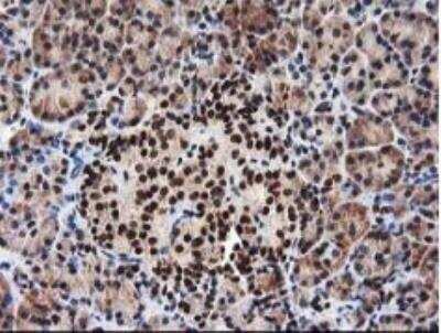 Immunohistochemistry-Paraffin NUDT18 Antibody (OTI5D7)