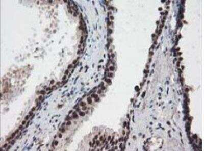 Immunohistochemistry-Paraffin: NUDT18 Antibody (OTI5D7) [NBP2-01432] - Staining of paraffin-embedded Human prostate tissue within the normal limits using anti-NUDT18 mouse monoclonal antibody. Heat-induced epitope retrieval by 10mM citric buffer, pH6.0, 100C for 10min.