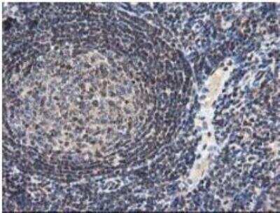 Immunohistochemistry-Paraffin: NUDT18 Antibody (OTI5D7) [NBP2-01432] - Staining of paraffin-embedded Human tonsil within the normal limits using anti-NUDT18 mouse monoclonal antibody. Heat-induced epitope retrieval by 10mM citric buffer, pH6.0, 100C for 10min.