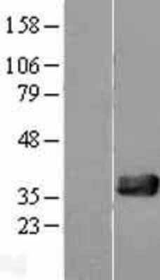 Western Blot: NUDT18 Overexpression Lysate (Adult Normal) [NBL1-13858] Left-Empty vector transfected control cell lysate (HEK293 cell lysate); Right -Over-expression Lysate for NUDT18.