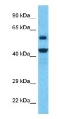 Western Blot: NUDT19 Antibody [NBP3-09678] - Western blot analysis of NUDT19 in RPMI-8226 Whole Cell lysates. Antibody dilution at 1.0ug/ml