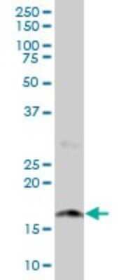 Western Blot: NUDT2 Antibody [H00000318-B01P] - Analysis of NUDT2 expression in human placenta.
