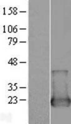 Western Blot: NUDT2 Overexpression Lysate (Adult Normal) [NBL1-13860] Left-Empty vector transfected control cell lysate (HEK293 cell lysate); Right -Over-expression Lysate for NUDT2.