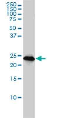 Western Blot: NUDT21 Antibody (2G4-6F11) [H00011051-M01] - Western Blot analysis of CPSF5 expression in A-431 ( Cat # L015V1 ).