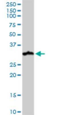 Western Blot: NUDT21 Antibody (2G4-6F11) [H00011051-M01] - NUDT21 monoclonal antibody (M01), clone 2G4-6F11. Analysis of NUDT21 expression in human kidney.