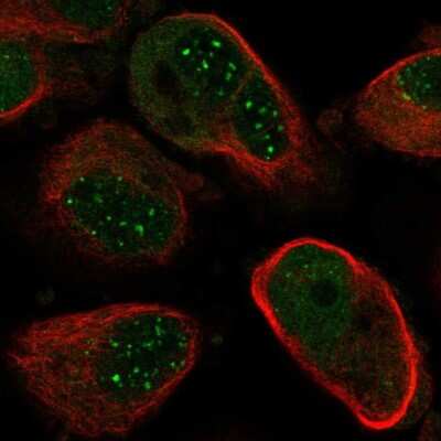 Immunocytochemistry/Immunofluorescence: NUDT21 Antibody [NBP2-57491] - Staining of human cell line PC-3 shows localization to nuclear bodies. Antibody staining is shown in green.