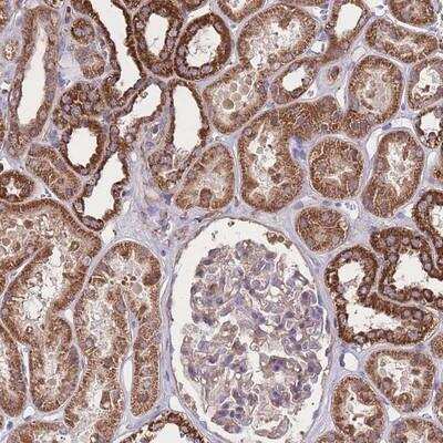 Immunohistochemistry: NUDT21 Antibody [NBP2-13682] - Staining of human kidney shows strong cytoplasmic positivity in renal tubules.