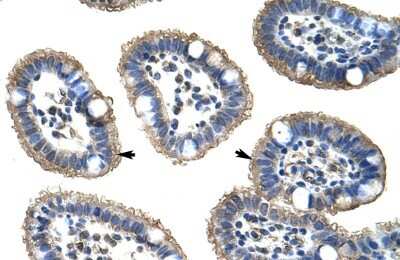 Immunohistochemistry-Paraffin: NUDT21 Antibody [NBP1-57540] - Human Intestine Tissue, antibody concentration 4-8ug/ml. Cells with positive label: Epithelial cells of intestinal villus (indicated with arrows) 400X magnification.