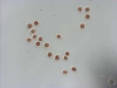 Immunohistochemistry: NUDT21 Antibody (OTI13H1) - Azide and BSA Free [NBP2-73113] - Staining of HT-29 cells using anti-NUDT21 mouse monoclonal antibody (1:100).