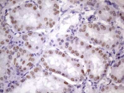 Immunohistochemistry: NUDT21 Antibody (OTI13H1) [NBP2-46276] - Analysis of Human Kidney tissue. (Heat-induced epitope retrieval by 1 mM EDTA in 10mM Tris, pH8.5, 120C for 3min)