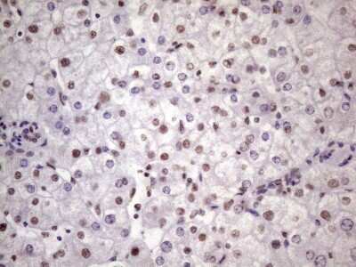 Immunohistochemistry: NUDT21 Antibody (OTI13H1) [NBP2-46276] - Analysis of Human liver tissue. (Heat-induced epitope retrieval by 1 mM EDTA in 10mM Tris, pH8.5, 120C for 3min)