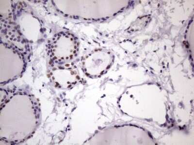 Immunohistochemistry: NUDT21 Antibody (OTI13H1) [NBP2-46276] - Analysis of Human thyroid tissue. (Heat-induced epitope retrieval by 1 mM EDTA in 10mM Tris, pH8.5, 120C for 3min)