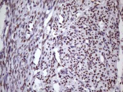 Immunohistochemistry: NUDT21 Antibody (OTI13H1) [NBP2-46276] - Analysis of Human endometrium tissue. (Heat-induced epitope retrieval by 1 mM EDTA in 10mM Tris, pH8.5, 120C for 3min)