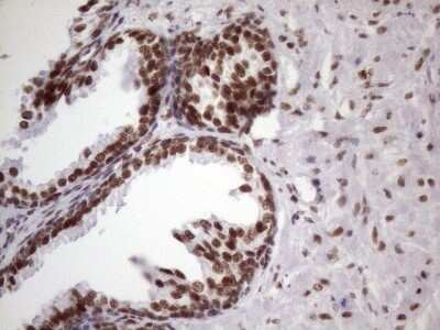 Immunohistochemistry: NUDT21 Antibody (OTI13H1) [NBP2-46276] - Analysis of Human prostate tissue. (Heat-induced epitope retrieval by 1 mM EDTA in 10mM Tris, pH8.5, 120C for 3min)