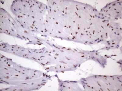 Immunohistochemistry: NUDT21 Antibody (OTI13H1) [NBP2-46276] - Analysis of Human bladder tissue. (Heat-induced epitope retrieval by 1 mM EDTA in 10mM Tris, pH8.5, 120C for 3min)