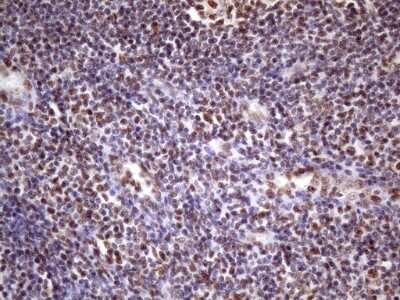 Immunohistochemistry: NUDT21 Antibody (OTI13H1) [NBP2-46276] - Analysis of Human tonsil tissue. (Heat-induced epitope retrieval by 1 mM EDTA in 10mM Tris, pH8.5, 120C for 3min)