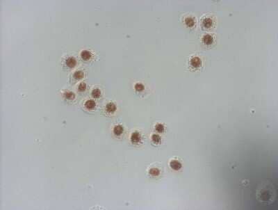 Immunohistochemistry-Paraffin: NUDT21 Antibody (OTI13H1) [NBP2-46276] - Staining of HT-29 cells using anti-NUDT21 mouse monoclonal antibody (1:100).