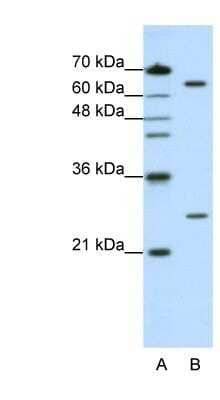 Western Blot: NUDT21 Antibody [NBP1-57540] - HepG2 cell lysate, Antibody Titration: 1.25ug/ml