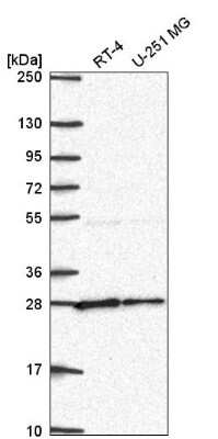 Western Blot: NUDT21 Antibody [NBP2-57491] - Analysis in human cell line RT-4 and human cell line U-251 MG.