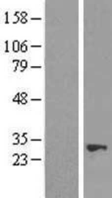 Western Blot: NUDT21 Overexpression Lysate (Adult Normal) [NBL1-13861] Left-Empty vector transfected control cell lysate (HEK293 cell lysate); Right -Over-expression Lysate for NUDT21.