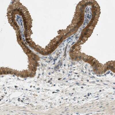 Immunohistochemistry-Paraffin: NUDT4 Antibody [NBP1-84250] - Staining of human gallbladder shows strong cytoplasmic positivity in glandular cells.