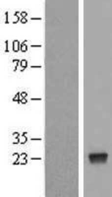 Western Blot: NUDT4 Overexpression Lysate (Adult Normal) [NBL1-13863] Left-Empty vector transfected control cell lysate (HEK293 cell lysate); Right -Over-expression Lysate for NUDT4.
