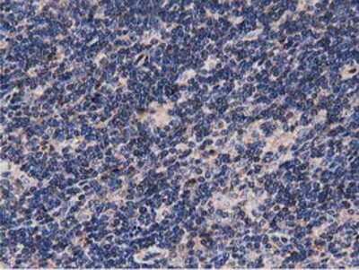 Immunohistochemistry-Paraffin: NUDT6 Antibody (9D12) [NBP2-03554] - Staining of paraffin-embedded Human lymphoma tissue using anti-NUDT6 mouse monoclonal antibody.