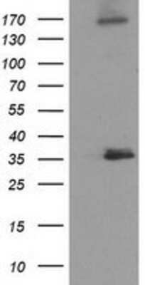 Western Blot NUDT6 Antibody (OTI9D12)