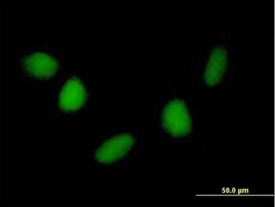 Immunocytochemistry/Immunofluorescence: NUDT6 Antibody [H00011162-B01P] - Analysis of purified antibody to NUDT6 on HepG2 cell. (antibody concentration 10 ug/ml)