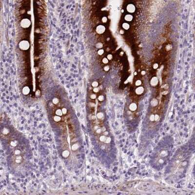 Immunohistochemistry: NUDT6 Antibody [NBP2-49473] - Staining of human small intestine shows strong cytoplasmic positivity in glandular cells.