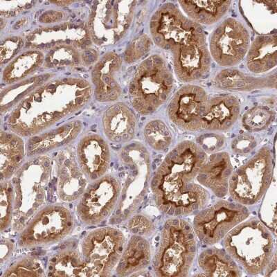 Immunohistochemistry-Paraffin: NUDT6 Antibody [NBP1-84688] - Staining of human kidney shows strong cytoplasmic and membranous positivity in cells in tubules.