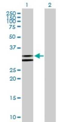 Western Blot: NUDT6 Antibody [H00011162-B01P] - Analysis of NUDT6 expression in transfected 293T cell line by NUDT6 polyclonal antibody.  Lane 1: NUDT6 transfected lysate(34.76 KDa). Lane 2: Non-transfected lysate.