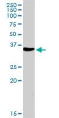 Western Blot: NUDT6 Antibody [H00011162-D01P] - Analysis of NUDT6 expression in human liver.