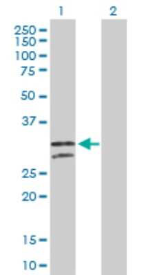 Western Blot: NUDT6 Antibody [H00011162-D01P] - Analysis of NUDT6 expression in transfected 293T cell line by NUDT6 polyclonal antibody.Lane 1: NUDT6 transfected lysate(35.70 KDa).Lane 2: Non-transfected lysate.