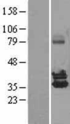 Western Blot: NUDT6 Overexpression Lysate (Adult Normal) [NBL1-13865] Left-Empty vector transfected control cell lysate (HEK293 cell lysate); Right -Over-expression Lysate for NUDT6.