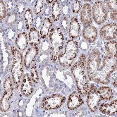 Immunohistochemistry-Paraffin: NUDT7 Antibody [NBP1-91125] - Staining of human kidney shows strong cytoplasmic positivity in granular pattern in tubule cells.