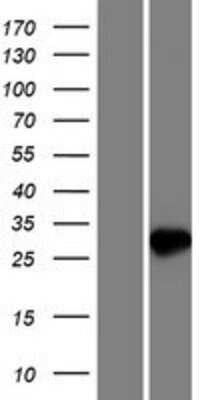 Western Blot: NUDT7 Overexpression Lysate (Adult Normal) [NBP2-09363] Left-Empty vector transfected control cell lysate (HEK293 cell lysate); Right -Over-expression Lysate for NUDT7.
