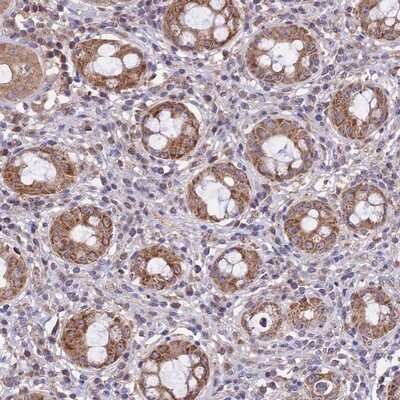 Immunohistochemistry-Paraffin NUDT8 Antibody - BSA Free