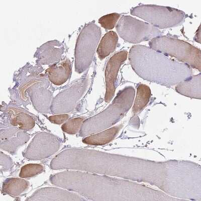 Immunohistochemistry-Paraffin NUDT8 Antibody - BSA Free