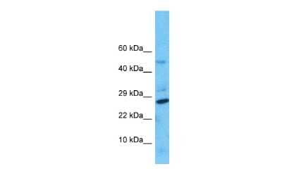 Western Blot: NUDT8 Antibody [NBP2-87964] - Host: Rabbit. Target Name: NUDT8. Sample Type: HepG2 Whole Cell lysates. Antibody Dilution: 1.0ug/ml