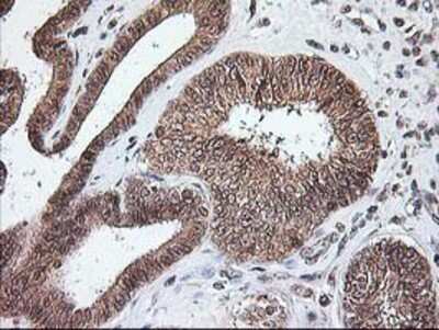 Immunohistochemistry-Paraffin NUDT9 Antibody (OTI7A12)