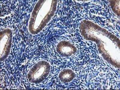 Immunohistochemistry-Paraffin: NUDT9 Antibody (7A12) [NBP2-01072] - Staining of paraffin-embedded Human endometrium tissue using anti-NUDT9 mouse monoclonal antibody.