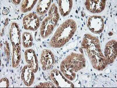 Immunohistochemistry-Paraffin: NUDT9 Antibody (7A12) [NBP2-01072] - Staining of paraffin-embedded Human Kidney tissue using anti-NUDT9 mouse monoclonal antibody.