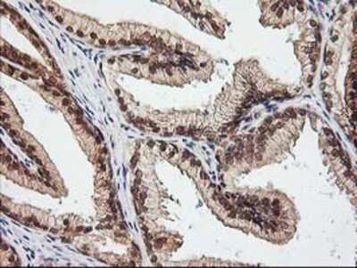 Immunohistochemistry-Paraffin: NUDT9 Antibody (7A12) [NBP2-01072] - Staining of paraffin-embedded Human prostate tissue using anti-NUDT9 mouse monoclonal antibody.