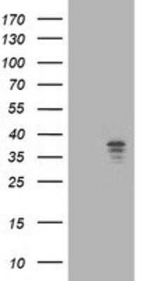 Western Blot: NUDT9 Antibody (7A12) [NBP2-01072] - HEK293T cells were transfected with the pCMV6-ENTRY control (Left lane) or pCMV6-ENTRY NUDT9 (Right lane) cDNA for 48 hrs and lysed. Equivalent amounts of cell lysates (5 ug per lane) were separated by SDS-PAGE and immunoblotted with anti-NUDT9.