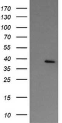 Western Blot: NUDT9 Antibody (OTI 7F12) - Azide and BSA Free [NBP2-73124] - Analysis of HEK293T cells were transfected with the pCMV6-ENTRY control (Left lane) or pCMV6-ENTRY NUDT9.