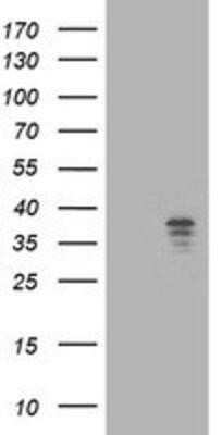 Western Blot: NUDT9 Antibody (OTI7A12) - Azide and BSA Free [NBP2-73126] - HEK293T cells were transfected with the pCMV6-ENTRY control (Left lane) or pCMV6-ENTRY NUDT9 (Right lane) cDNA for 48 hrs and lysed. Equivalent amounts of cell lysates (5 ug per lane) were separated by SDS-PAGE and immunoblotted with anti-NUDT9.