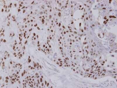 Immunohistochemistry-Paraffin: NULP1 Antibody [NBP1-31374] - FaDu xenograft, using NULP1 antibody at 1:100 dilution. Antigen Retrieval: Citrate buffer, pH 6.0, 15 min.