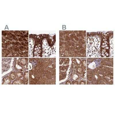 <b>Independent Antibodies Validation. </b>Immunohistochemistry-Paraffin: NULP1 Antibody [NBP1-92210] - Staining of human adrenal gland, colon, kidney and liver using Anti-TCF25 antibody NBP1-92210 (A) shows similar protein distribution across tissues to independent antibody NBP1-92211 (B).